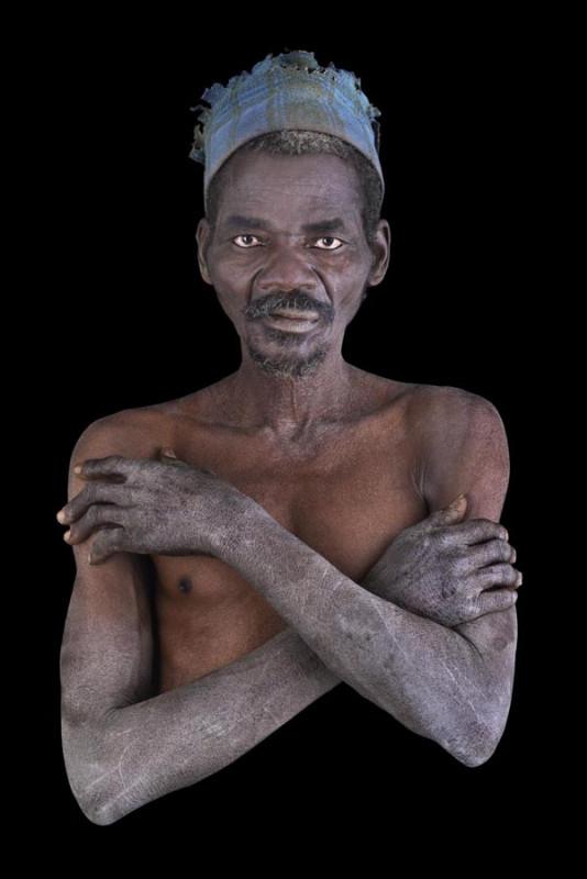 Lompo Youmali
