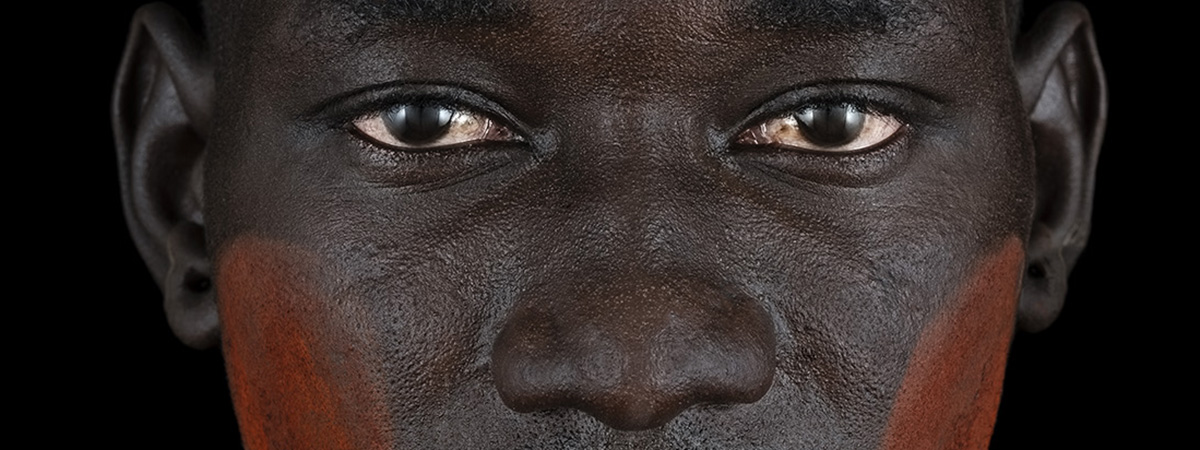 Ethiopie